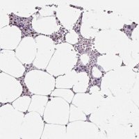 Anti-SF3B5 antibody produced in rabbit HPA054408-100UL