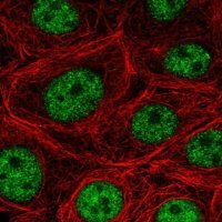 Anti-SF3B5 antibody produced in rabbit HPA054408-100UL