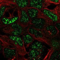 Anti-SFMBT2 antibody produced in rabbit 