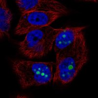 Anti-SFRP1 antibody produced in rabbit HPA064870-100UL