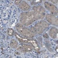 Anti-SGK2 antibody produced in rabbit HPA011387-100UL