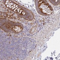 Anti-SGK494 antibody produced in rabbit HPA046590-100UL