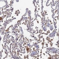 Anti-SGMS1 antibody produced in rabbit 