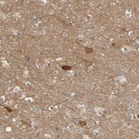 Anti-SGSM1 antibody produced in rabbit 