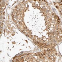 Anti-SGSM1 antibody produced in rabbit 