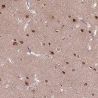 Anti-SH3BGRL2 antibody produced in rabbit 