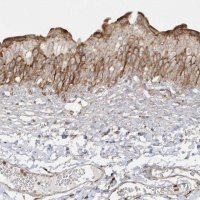 Anti-SH3BP2 antibody produced in rabbit HPA036790-100UL