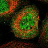 Anti-SH3GLB2 antibody produced in rabbit