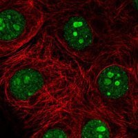 Anti-SH3TC1 antibody produced in rabbit 