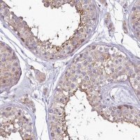 Anti-SH3TC2 antibody produced in rabbit 