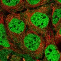 Anti-SIK3 antibody produced in rabbit 