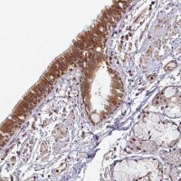 Anti-SIMC1 antibody produced in rabbit 