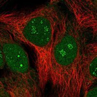 Anti-SIMC1 antibody produced in rabbit 