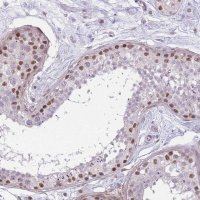 Anti-SIN3B antibody produced in rabbit 