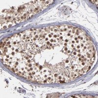 Anti-SIPA1L1 antibody produced in rabbit