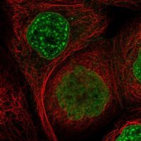 Anti-SIPA1L3 antibody produced in rabbit