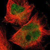 Anti-SKIL antibody produced in rabbit