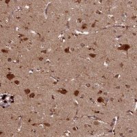 Anti-SLC11A2 antibody produced in rabbit 