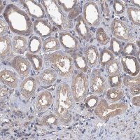 Anti-SLC12A7 antibody produced in rabbit 