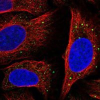 Anti-SLC14A1 antibody produced in rabbit HPA058353-100UL
