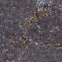 Anti-SLC15A4 antibody produced in rabbit 