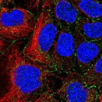 Anti-SLC16A10 antibody produced in rabbit 