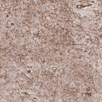 Anti-SLC16A2 antibody produced in rabbit 