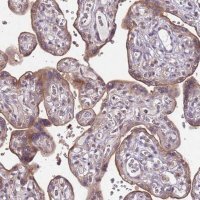 Anti-SLC16A4 antibody produced in rabbit