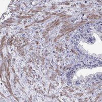 Anti-SLC16A8 antibody produced in rabbit