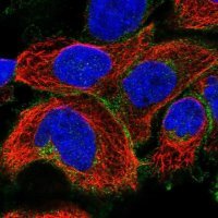 Anti-SLC19A1 antibody produced in rabbit 