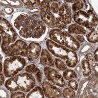 Anti-SLC25A10 antibody produced in rabbit 