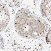 Anti-SLC25A26 antibody produced in rabbit 