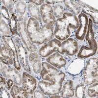 Anti-SLC25A31 antibody produced in rabbit
