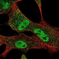 Anti-SLC25A45 antibody produced in rabbit