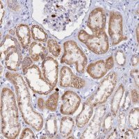 Anti-SLC26A1 antibody produced in rabbit 