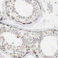 Anti-SLC27A4 antibody produced in rabbit 