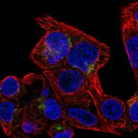 Anti-SLC29A3 antibody produced in rabbit HPA057905-100UL