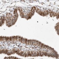 Anti-SLC35A2 antibody produced in rabbit