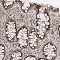 Anti-SLC35A2 antibody produced in rabbit