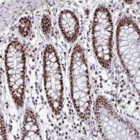 Anti-SLC35C2 antibody produced in rabbit