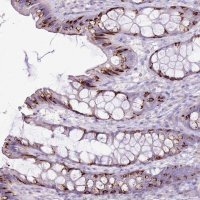 Anti-SLC38A5 antibody produced in rabbit