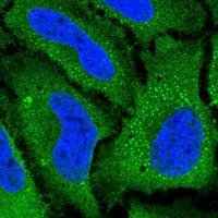 Anti-SLC38A5 antibody produced in rabbit