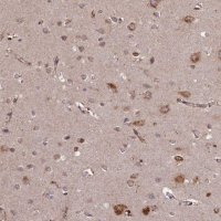 Anti-SLC38A7 antibody produced in rabbit 