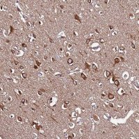 Anti-SLC41A3 antibody produced in rabbit 
