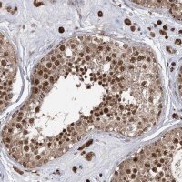 Anti-SLC4A1AP antibody produced in rabbit