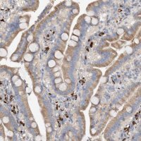 Anti-SLC5A11 antibody produced in rabbit