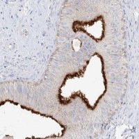 Anti-SLC5A6 antibody produced in rabbit 