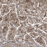 Anti-SLC9A2 antibody produced in rabbit