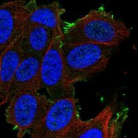 Anti-SLCO1A2 antibody produced in rabbit 