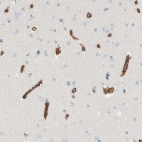 Anti-SLFN12 antibody produced in rabbit 